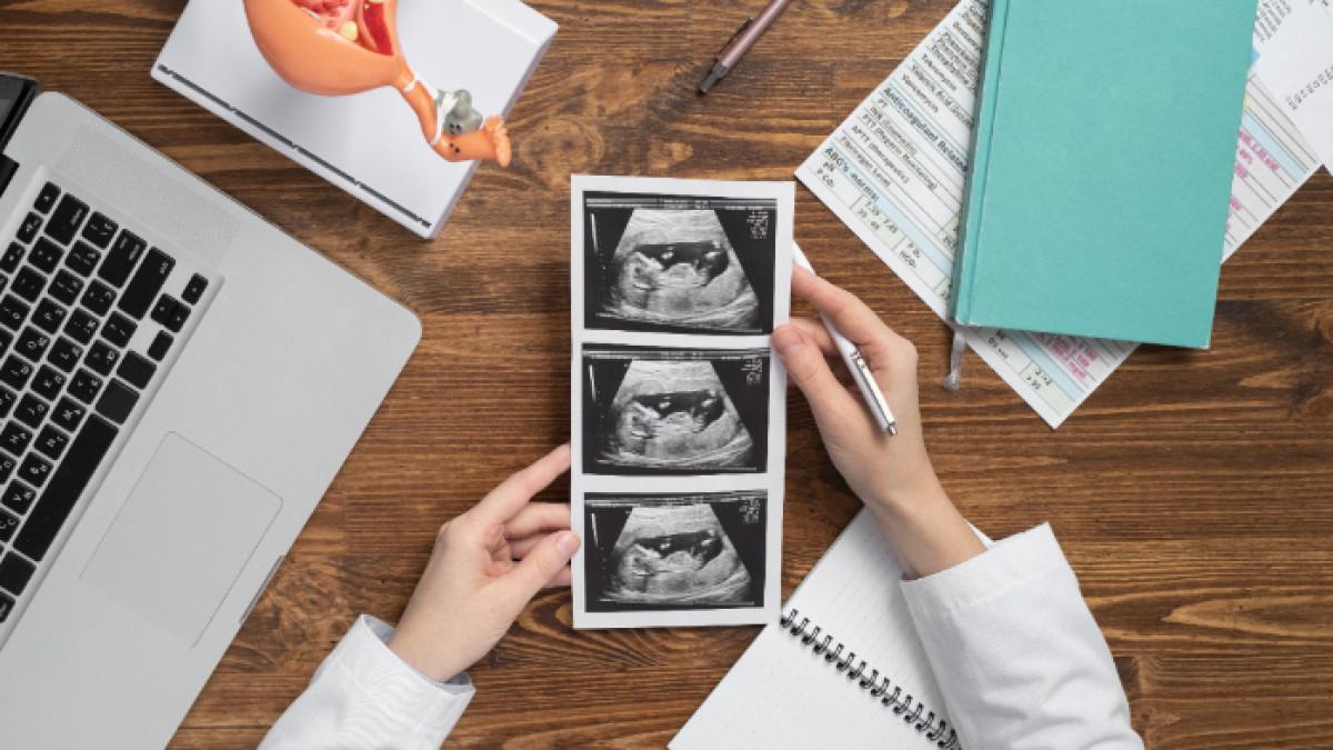 Persiapan Utama Sebelum Inseminasi Buatan