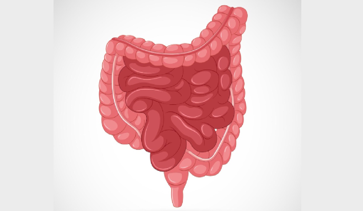 168 Bahan Kimia dan Dampaknya Terhadap Bakteri Usus